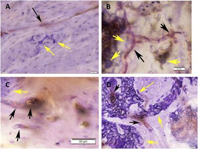 A tissue engineered 3D printed calcium alkali phosphate bioceramic bone graft enables vascularization and regeneration of critical-size discontinuity bony defects in vivo